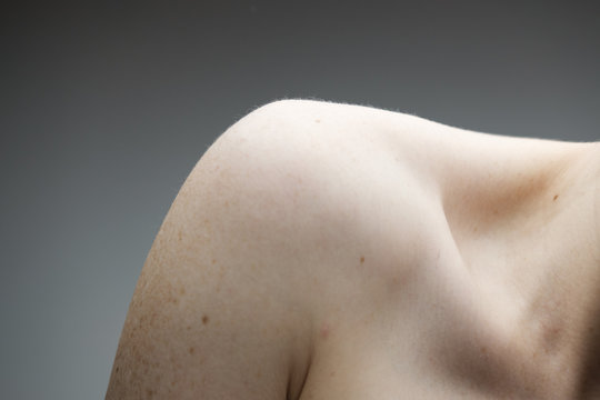woman with no face exposing her left shoulder and collar bone with pale skin and freckles