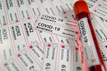 Covid-19 infectious disease, coronavirus a global threat
sars-cov 2 pasitive blood test