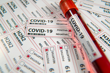 Covid-19 infectious disease, coronavirus a global threat
sars-cov 2 pasitive blood test