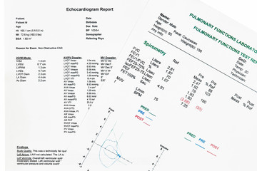Fototapeta premium Close up of Pulmonary Functions Test and ECG Report