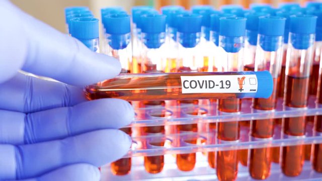 A lab doctor wearing blue gloves holding a sample kit of the COVID-19 coronavirus