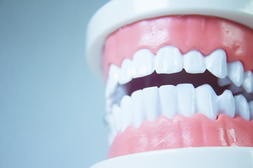 Model denture with metal orthodontics
