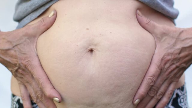 Woman measuring her belly fat