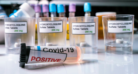 Treatment prepared for patients infected with covid-19 coronavirus in a laboratory, conceptual image