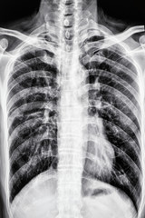 Perspective view of human chest