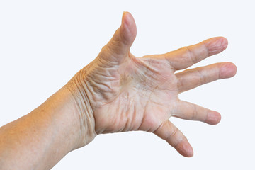Senior woman has Dry hand and Peel in the middle of the palm, Dermatitis, Skin infections, Close up shot, Healthcare concept