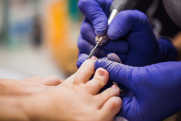 Hardware pedicure procedure