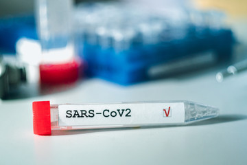 Fototapeta premium Coronavirus test. test tube with laboratorytable. COVID-19 or SARS-CoV-2 test concept.