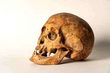 schädel,skull,anatomie, mensch, weiß, bones, kopf, zahn