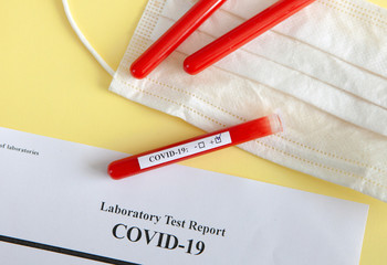 World coronavirus epidemic concept. Pandemic COVID-19, 2019-nKoV. Coronavirus vaccine testing....