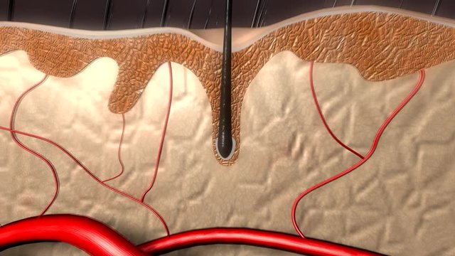모근영양결핍으로 머리카락 빠진다.