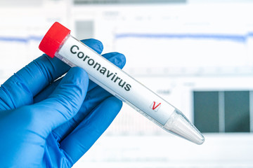 Coronavirus or COVID-19 test. Hand in gloves holds a tube SARS-CoV-2 and ncov-19 test