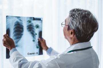 Asian man doctor diagnose patient x-ray radiography film lung detected coronavirus covid-19 infection
