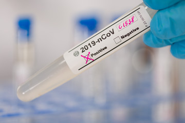 close up of hand in medical gloves handling coronavirus test tubes with positive result