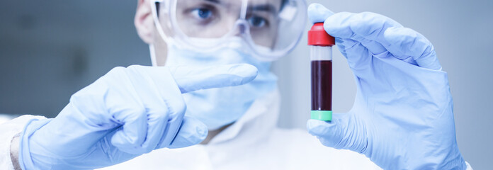 coronavirus covid 19 infected blood sample in sample tube in hand of scientist with biohazard...