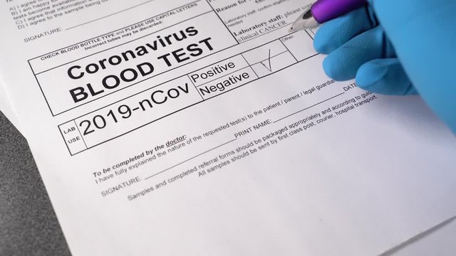 Coronavirus negative test. Medical worker hand with blue surgical gloves marking blood test result as negative for the COVID-19 on the white test page. No panic, infection, Covid-19.