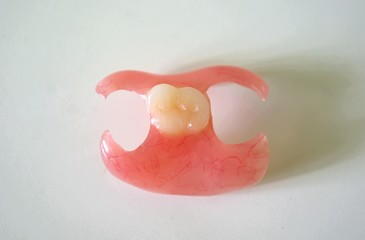 Removable denture type Butterfly on a light background. Replacement of one missing tooth. Closeup.