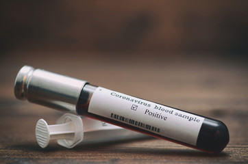 Coronavirus 2019-nCoV Blood Sample . Epidemic virus Respiratory Syndrome stock photo. Test tube...