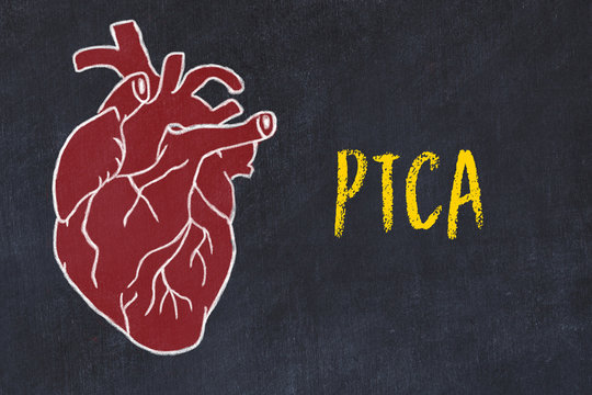 Concept of learning cardiovascular system. Chalk drawing of human heart and inscription PTCA