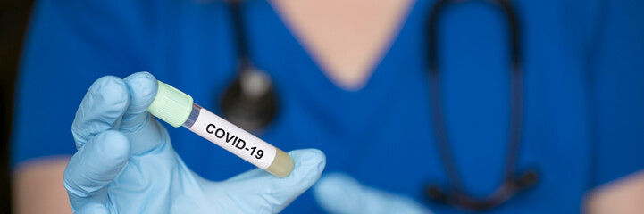 test tube in hand of lab technician with sample of coronavirus covid-19, deadly global pandemic concept