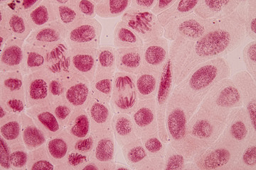 Root tip of Onion and Mitosis cell in the Root tip of Onion under a microscope.
