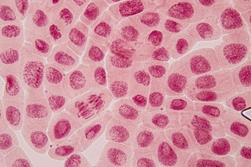 Root tip of Onion and Mitosis cell in the Root tip of Onion under a microscope.
