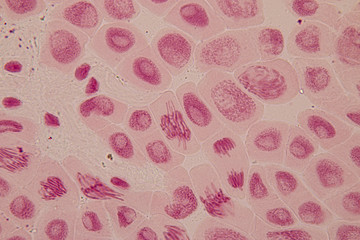 Root tip of Onion and Mitosis cell in the Root tip of Onion under a microscope.

