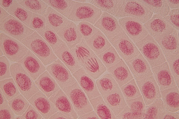 Root tip of Onion and Mitosis cell in the Root tip of Onion under a microscope.

