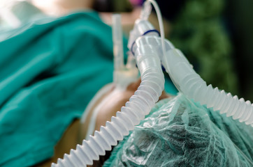 Patient with an endotracheal tube in operation theater