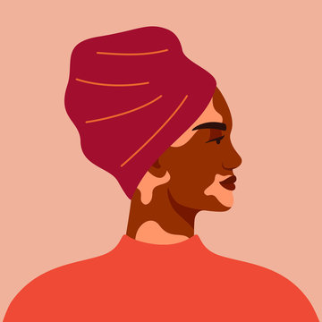 Portrait of black woman with vitiligo wearing turban. Avatar of young african girl with pigmentation on the skin. Vector illustration