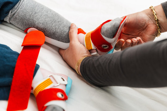 pies de un ni&ntilde;o de 5 a&ntilde;os con f&eacute;rulas ortop&eacute;dicas para poder aprender ha andar, sujeci&oacute;n de los pies, pr&oacute;tesis pierna. la madre o fisioterapeuta se los est&aacute; poniendo para los ejercicios terap&eacute;uticos.