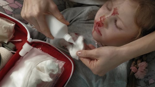 Mom provides first aid to a child with a bloody nose.