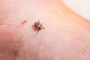 Mite on the skin. Danger of tick bite.