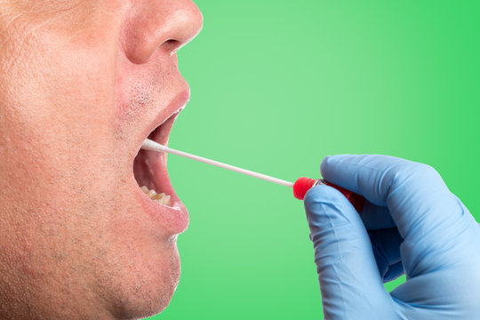 DNA test, wipe test