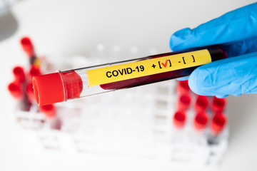 Obraz premium Corona virus blood test concept: A hand with blue gloves is holding a test tube with POSITIVE COVID-19 result in laboratory