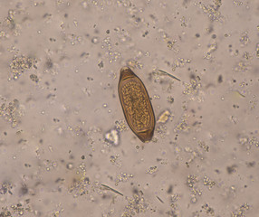 Egg parasite in stool exam.
