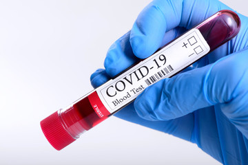 Obraz premium COVID-19 test and laboratory sample of blood isolated on white