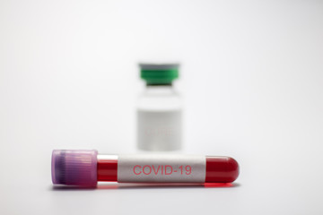 Covid-19 blood sample test tube and Vaccine for prevention,cure and treatment from coronavirus infection