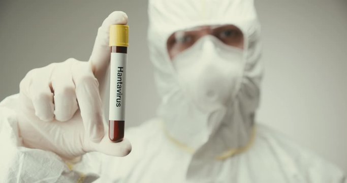 Scientist laboratory protection glasses test tube concept Hanta virus blood gray background showing