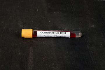 Blood tube for corona virus test on black background