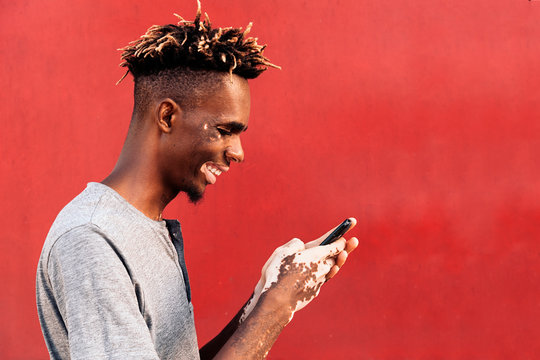 Profile of man smiling with depigmentation condition called vitiligo