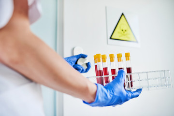 Hands in protective gloves holding blood samples for testing in a protected area in a hospital