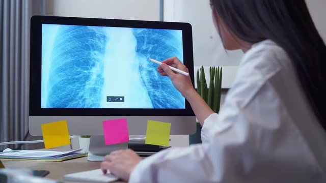 Close-up Female doctor working by digital pen touch screen for examining patient chest x-ray on computer application.