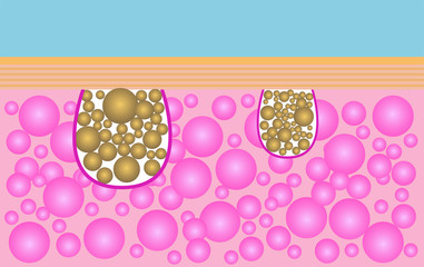 unclog pores,skin care