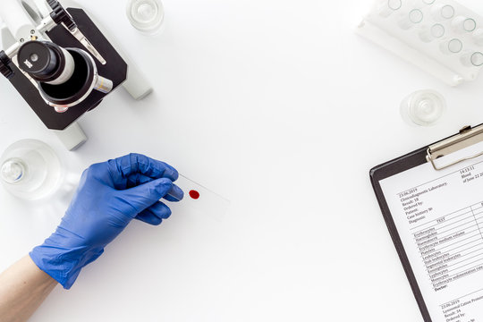 Bood testing with microscope in laboratory. Sample in hands on white background top view copy space