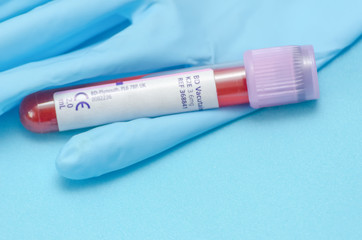 test tube with blood is lying on a blue glove close up on a blue background