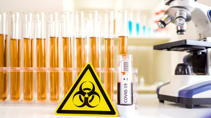 A yellow biological hazard sign beside the blood sample with positive mark for coronavirus