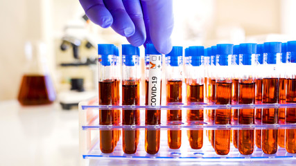 Putting the test samples with positive mark of COVID-19 coronavirus