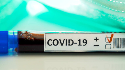 The test tube kit with the Covid-19 sign for coronavirus