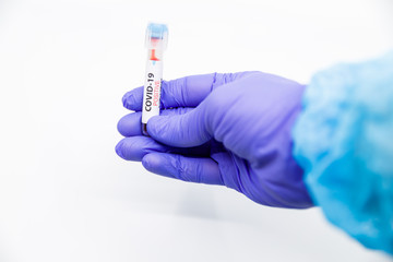 Closeup of microbiologist or medical worker hand with blue surgical gloves marking blood test result as positive for the new rapidly spreading Coronavirus. COVID-19 Positive concept